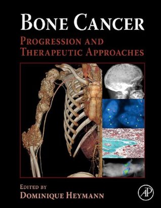 Full Download Bone Cancer: Progression and Therapeutic Approaches - Dominique Heymann file in ePub