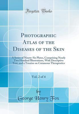 Full Download Photographic Atlas of the Diseases of the Skin, Vol. 2 of 4: A Series of Ninety-Six Plates, Comprising Nearly Two Hundred Illustrations, with Descriptive Text, and a Treatise on Cutaneous Therapeutics (Classic Reprint) - George Henry Fox file in PDF