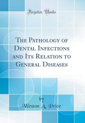 Full Download The Pathology of Dental Infections and Its Relation to General Diseases (Classic Reprint) - Weston A. Price | PDF